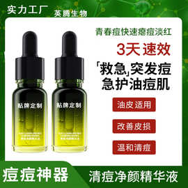 贴牌小绿瓶qu痘精华液面部抑痘精华油痘肌控油专用代工OEM跨境