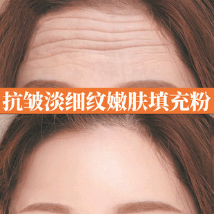 Collagen Filling Powder Cream to Remove Forehead Wrinkles, Remove Nasolabial Folds, Hydrate and Plump Face, Polypeptide Essence Powder Filling Powder Hospital Line