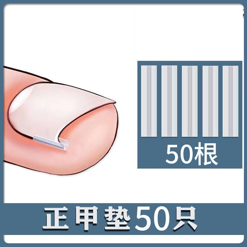 甲溝は甲の矯正器の正甲のパッドを入れて爪を詰めて肉の中に長い隔離パッドを入れて足の爪のパッチ炎を是正します。|undefined