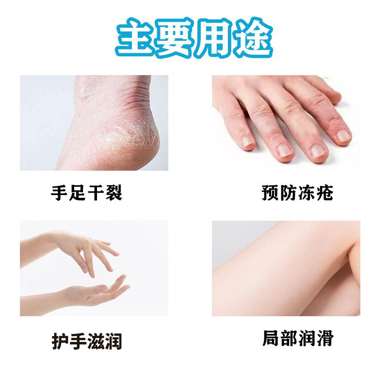 Lónglìqí Snake Oil Cream 8g Hand Cream Herbal Anti-Frost Massage Cream Skin Smoothing Cream Foot Bath Special Use