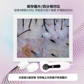 15寸三光谱头皮毛囊检测仪保存图片一体机双镜头检测智能检测