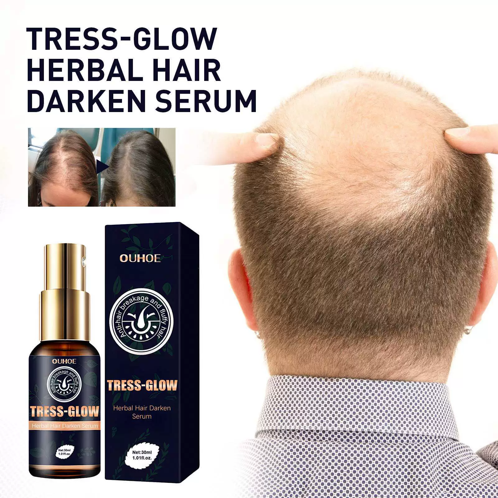 OUHOE Травяная густая эссенция для волос Массаж увлажняет кожу головы, корни волос жесткие, эластические, густые и густые Уход за бородой Сущность