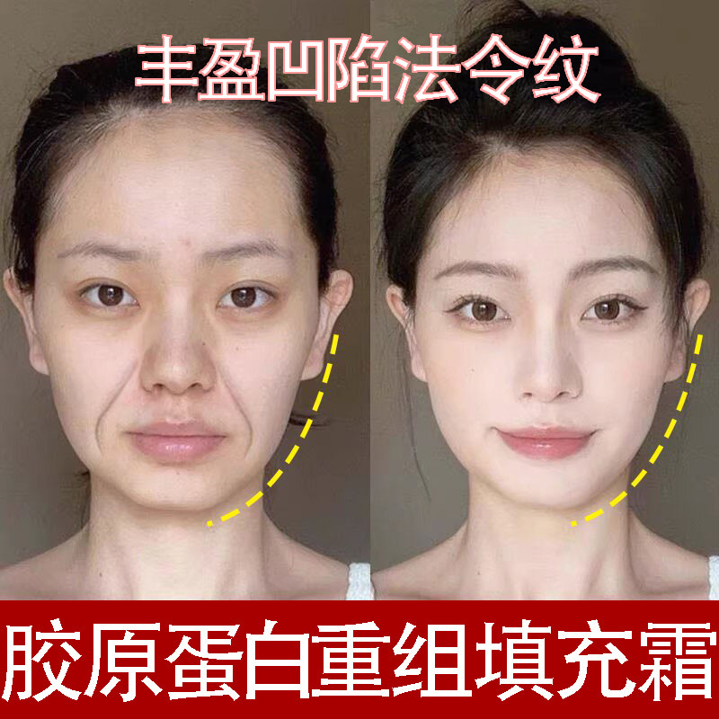 Collagen Filling Cream, Anti-Wrinkle Firming Cream, Anti-Aging Cream, Filling Sunken Areas, Rejuvenating Cream, Restructuring Cream Collagen Filling Cream, Anti-Wrinkle Firming Cream, Anti-Aging Cream, Filling Sunken Areas, Rejuvenating Cream, Restructuring Cream