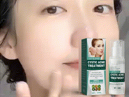 Jaysuing Kwas salicylowy Cystic do usuwania, zamykania, kremu naprawczego do twarzy z odciskami trądziku_voghion.com