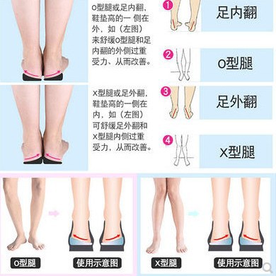 Plantillas correctoras de silicona para piernas en forma de X, plantillas con imán volcánico, almohadillas para el talón que absorben los golpes, plantillas funcionales de media talla, dropshipping y distribución.