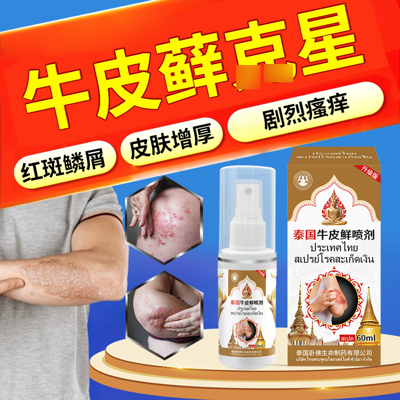 タイの臥仏の牛のコケの銀の頭の皮の白癬は菌を診察して皮膚のかゆみに感染して頑固な牛のコケのかゆみを止めますスプレー|undefined