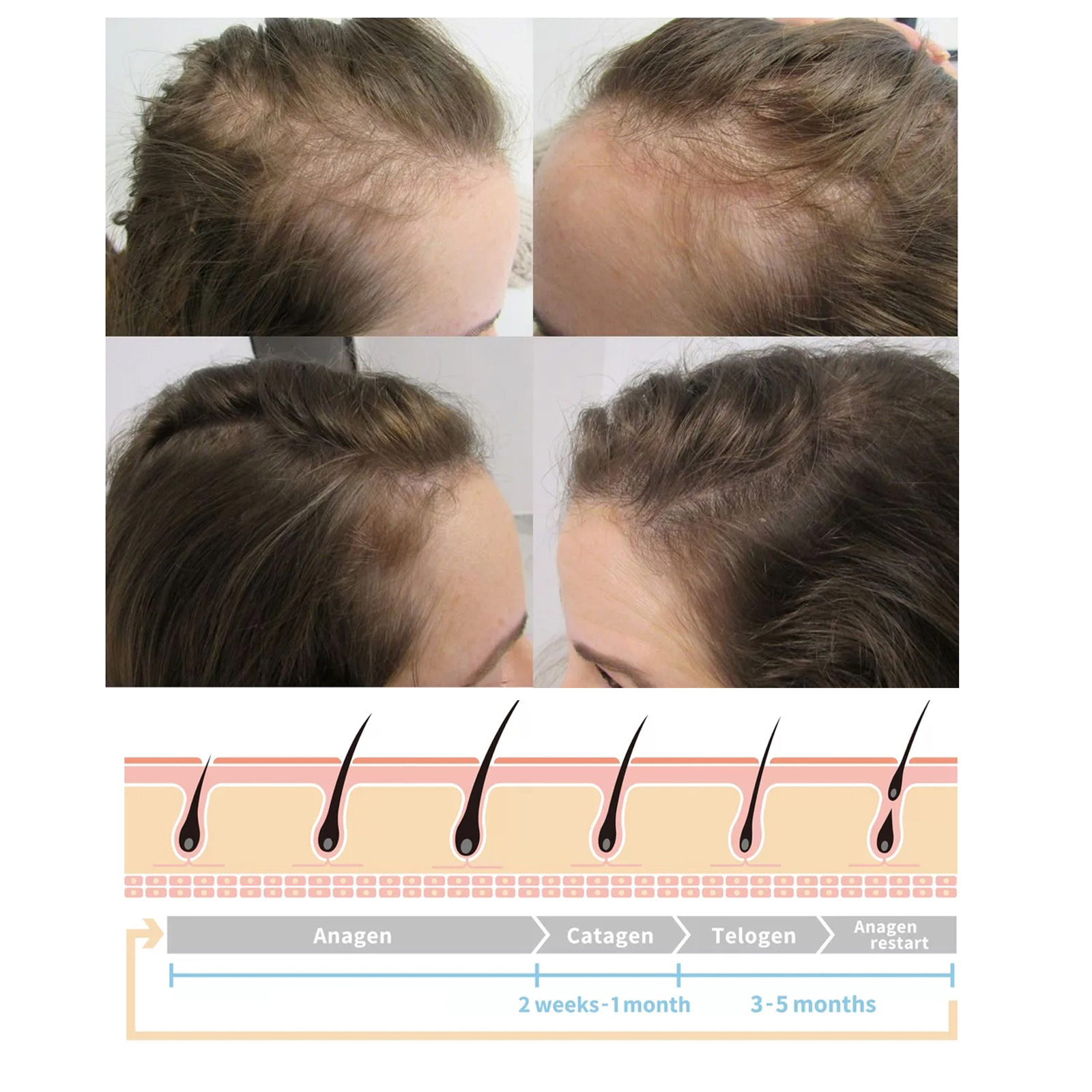 Haargroei spray met gember voor haarwortel versterking_voghion.com