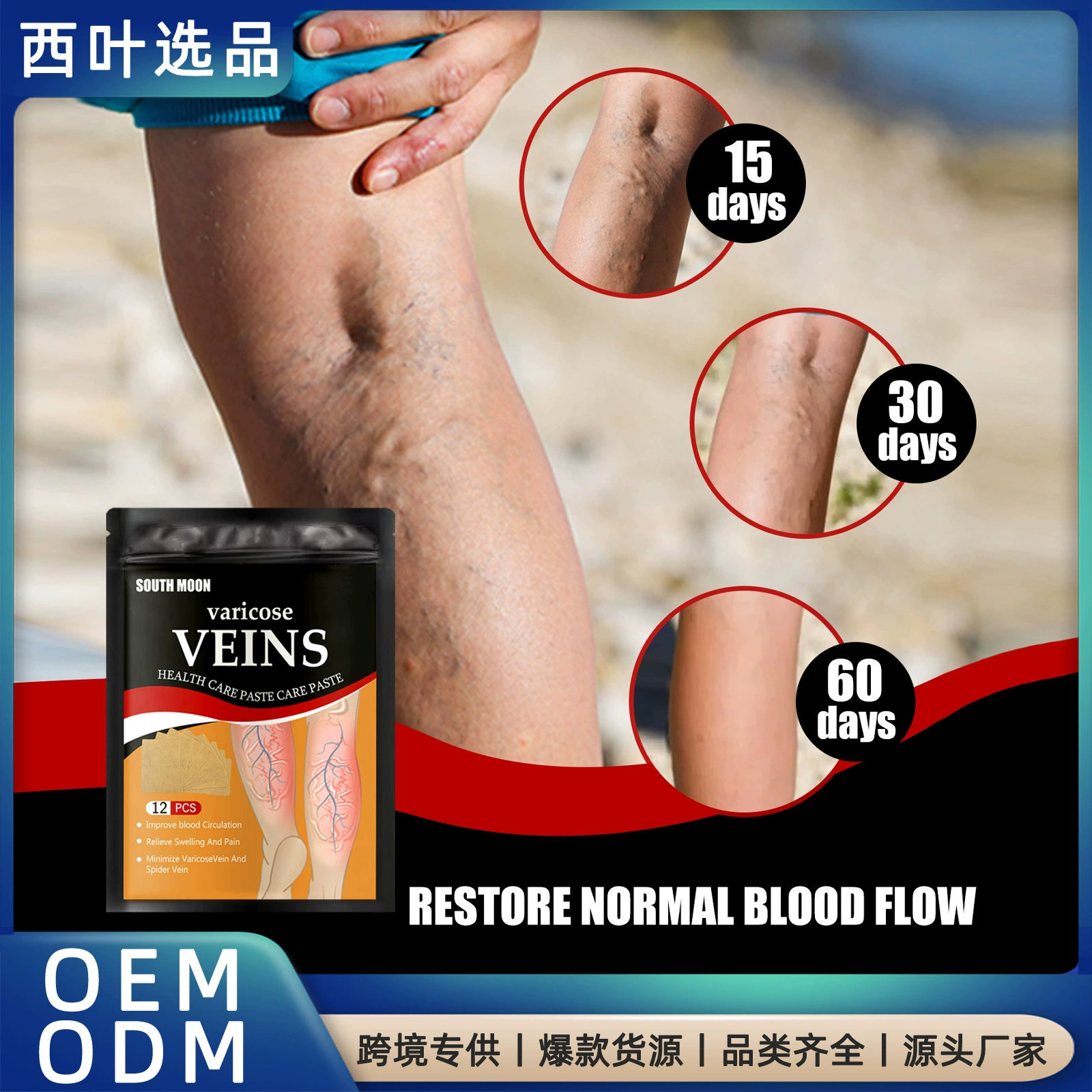 Венозный пластырь здоровья Южной Луны для снятия блокировки изогнутых кровеносных сосудов ног Холодный компресс Венозный пластырь здоровья