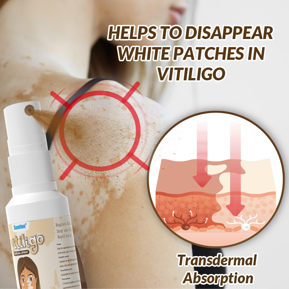 Sumifun Transfrontier White Spot Treatment Kit AliExpress Amazon Transfrontier Camarón yeso spray líquido de comercio exterior
