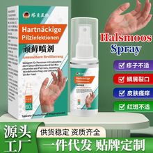 顽藓喷剂皮肤止痒喷雾皮肤瘙痒不适手部草本护理喷雾代发顽藓喷剂