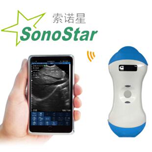 Sonostar���Z�ǿ羳�汾 �o�����ϳ� �F��΢͹���l����m��؈��