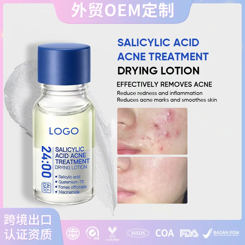 Кросс-бордерный продукт для Юго-Восточной Азии: OEM эссенция против акне с салициловой кислотой, контролирующая жирность, эссенция от прыщей.