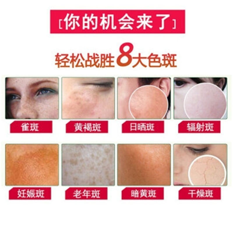 377VC ブラッククリーム、シミを薄くし、美白し、黄ばみ、肝斑を除去し、メラニンを抑制する美容サロン用カラーコントロールクリーム|undefined