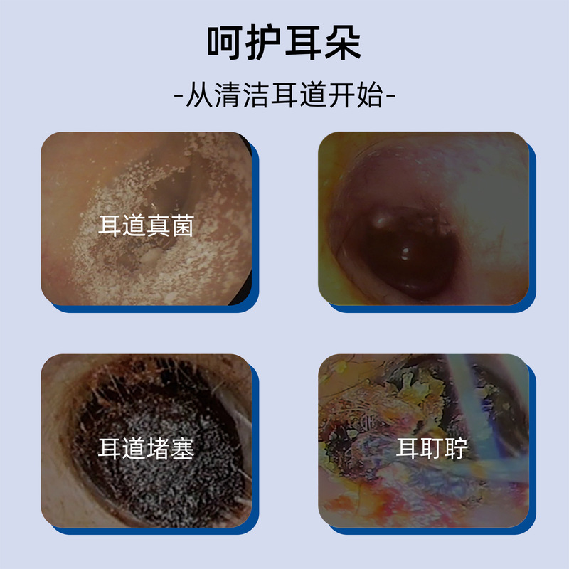 国药健康硼酸酒精抑菌液耳朵发痒耳道堵塞清洁软化耵聍滴耳液|undefined