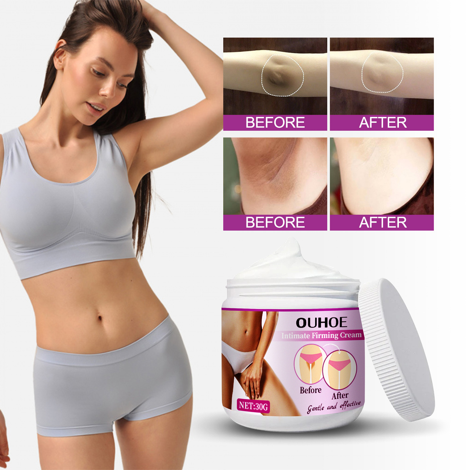 OUHOE krema za učvrstitev kože za pazduhe, komolce, ten kože, melanin za posvetlitev in beljenje kože,_voghion.com