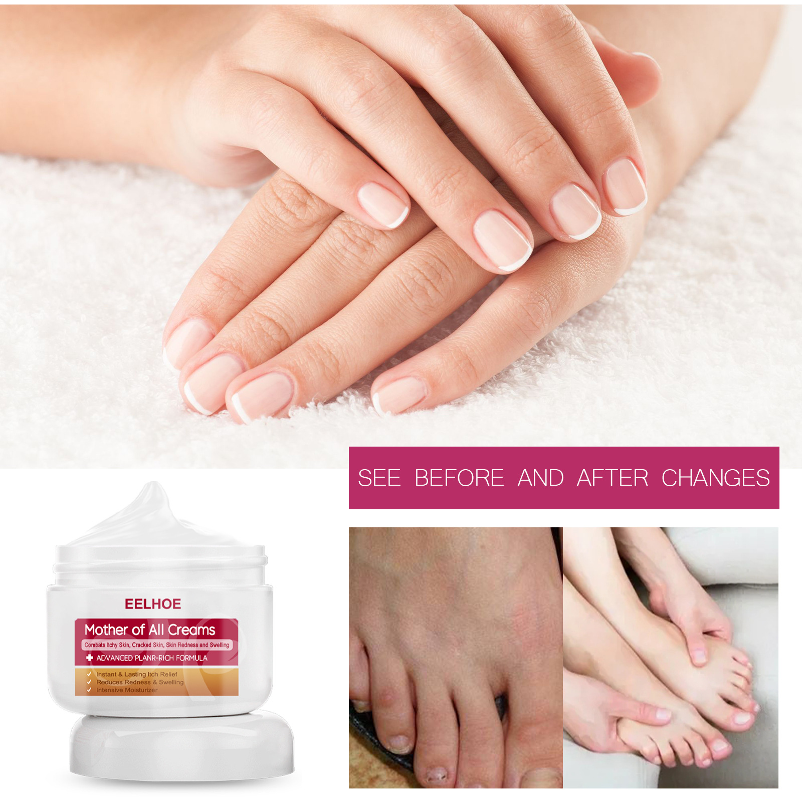 Eelhoe Skin Cream Powder Jar - Softening, Refreshing, Delicate, Comfortable, Moisturizing Cream for Hands and Feet
