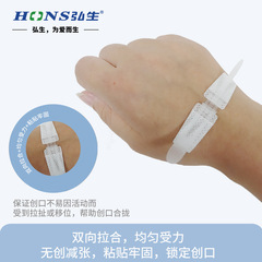 弘生減張器免縫合傷口縫合器無紡布拉鏈式創口貼 皮膚減張吻合器