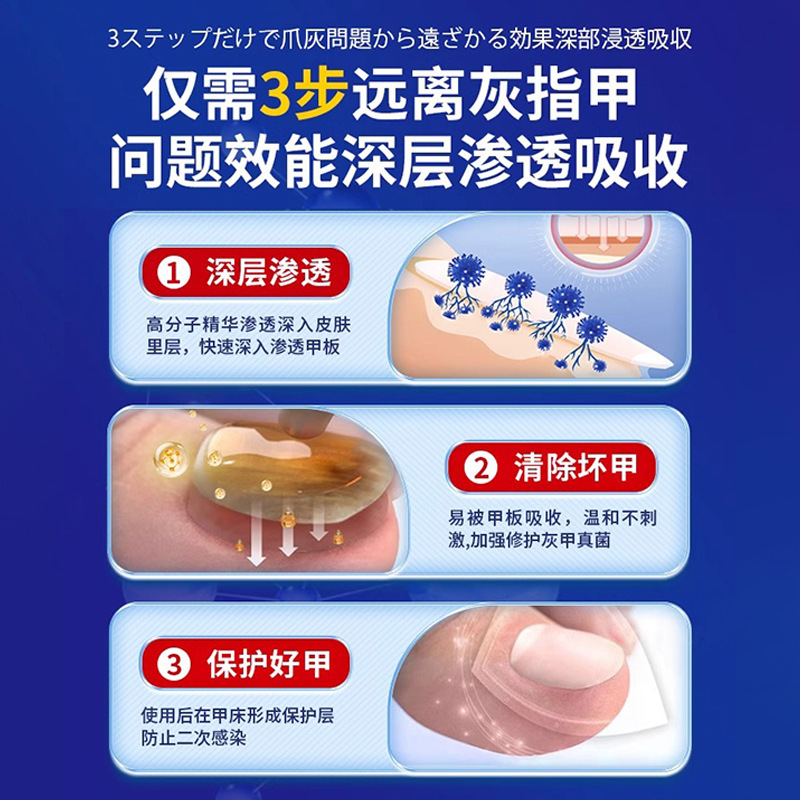 岩井弘灰爪亮甲脱甲増厚発黄専用鳳仙花抗菌液氷酢酸工場直営|undefined