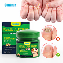 sumifun�羳��ҩ����ѷ��ָ�ױ������ָ�ױ������º��ֻ� k10287