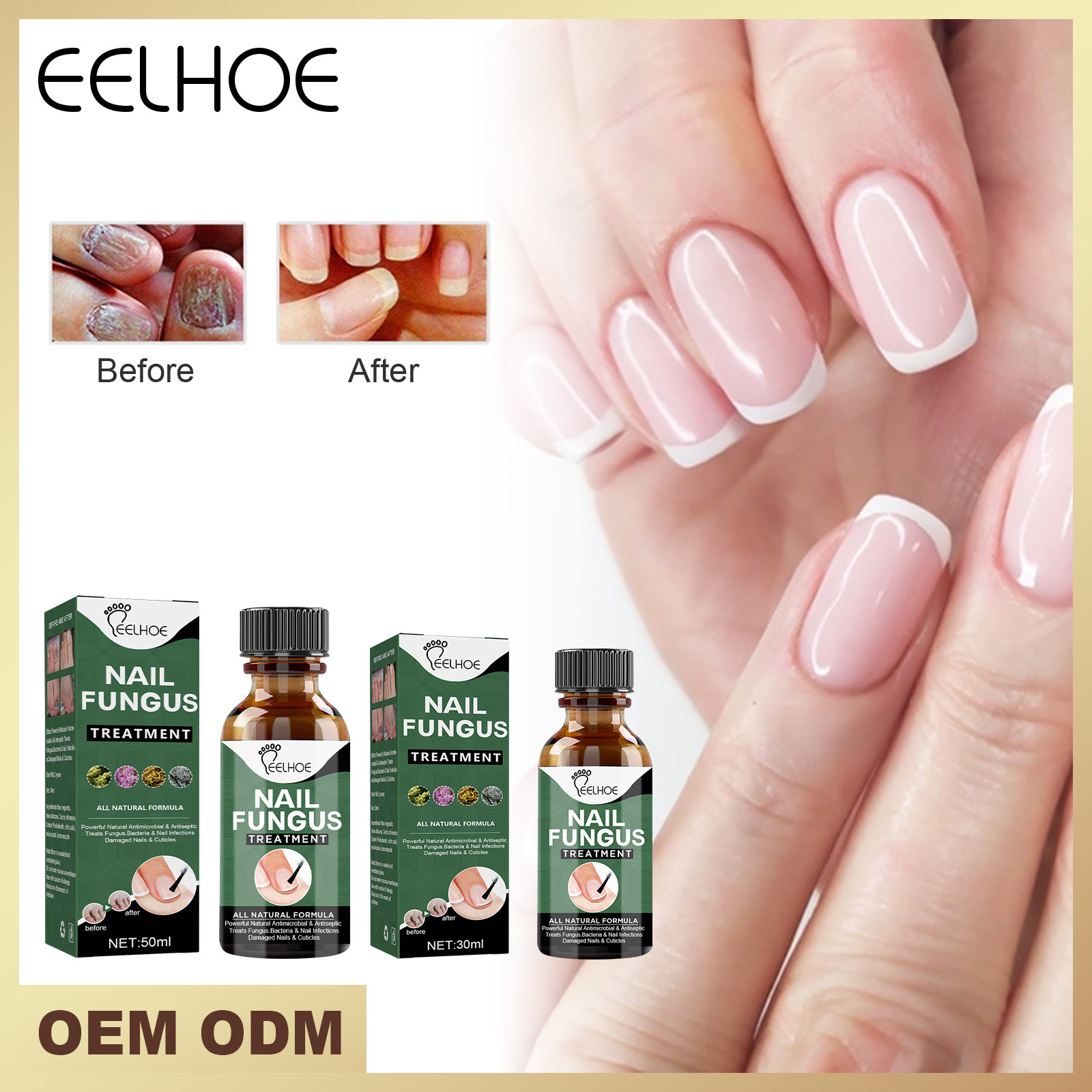 fungo toe anti remover unha onychomycosis essência