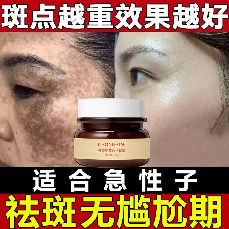 强效祛斑霜美白去黑色素淡化色斑去黄褐斑老年斑雀斑炸斑王提亮