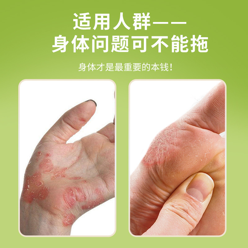 香港大药房狼毒清膏体股手足外用乳膏瘙痒膏皮肤脱皮膏批发|undefined