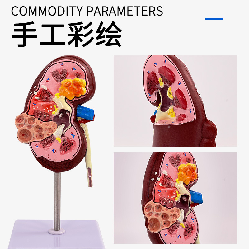 ����������ģ��,��������ģ�� ����ģ�� �����������ٽ���ģ��