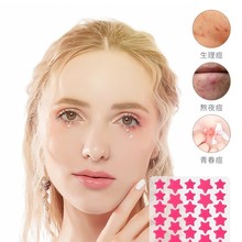 ACNEˮ�z�w�F؛͸��40�����Ƕ����N�[�΃����N��Ů��ˮ�ഺ�����N