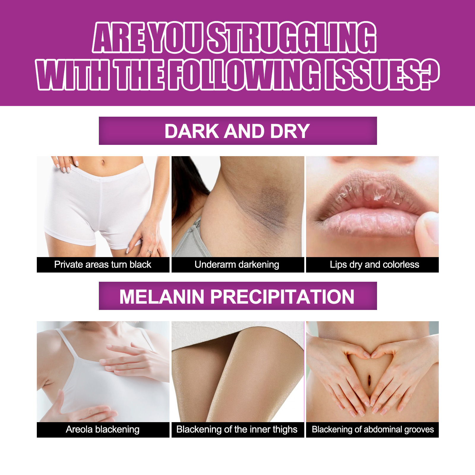 OUHOE krema za učvrstitev kože za pazduhe, komolce, ten kože, melanin za posvetlitev in beljenje kože,_voghion.com