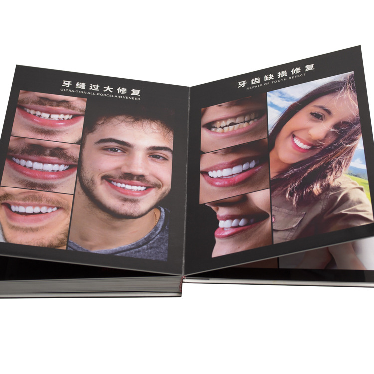 Belleza dental, carilla de porcelana de hielo, parche de cerámica sin metal, álbum de fotos de cristal, catálogo de visualización del cliente, material dental, carilla de porcelana de hielo image 5
