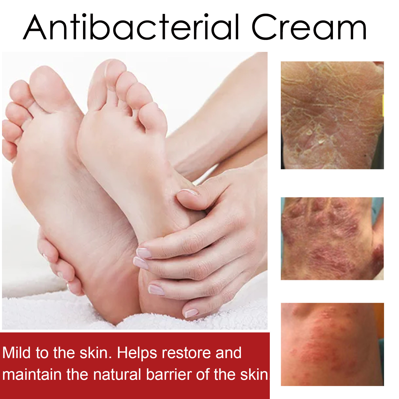 South Moon Psoriasis Care Cream Zarudnutí pokožky těla, svědění, krém proti svědění a lupénce na rukou a nohou_voghion.com