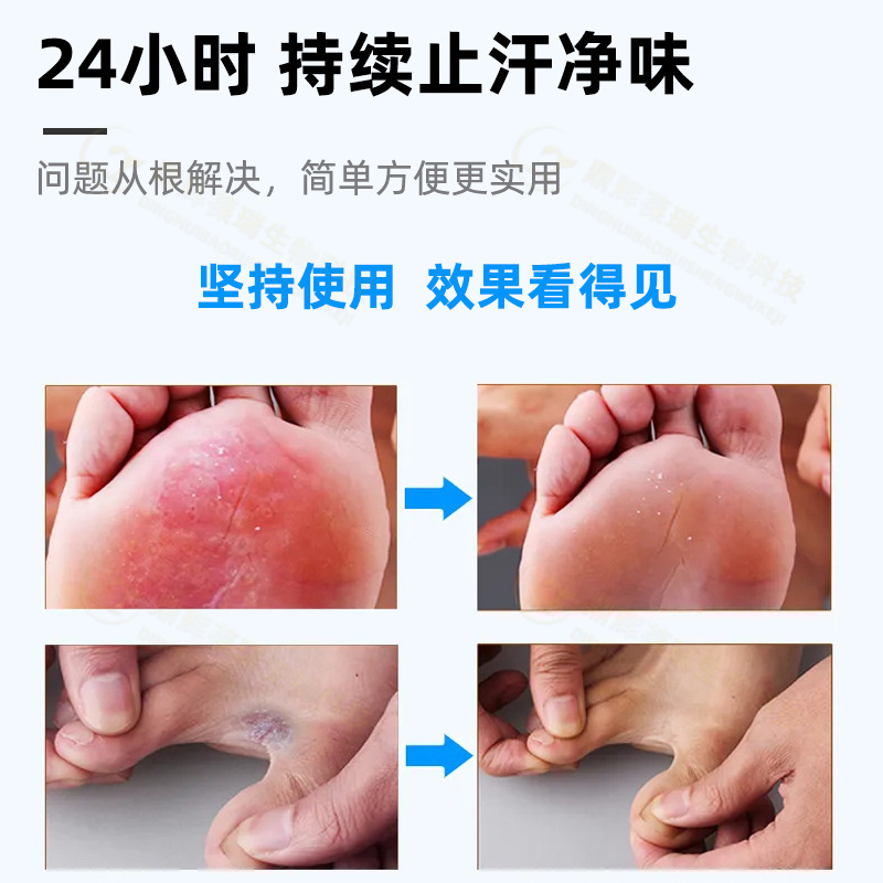 足裏爽快足キネット軟膏 足健康ケア軟膏 汗ばむ足・足臭スプレーケア液 皮膚軟膏 足湯液|undefined