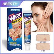 HBESTY Wart Remove 羳ƽ Ƥwu۟oo