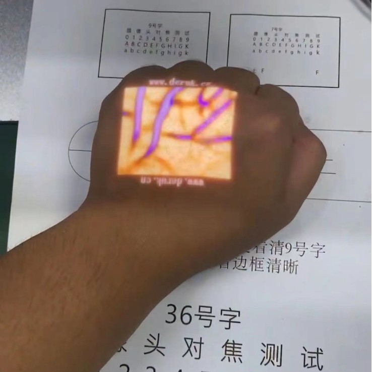 外国貿易専用血管イメージャー 静脈血管イメージャー 静脈ディスプレイ 充電式 新型スクリーン投影付き|undefined