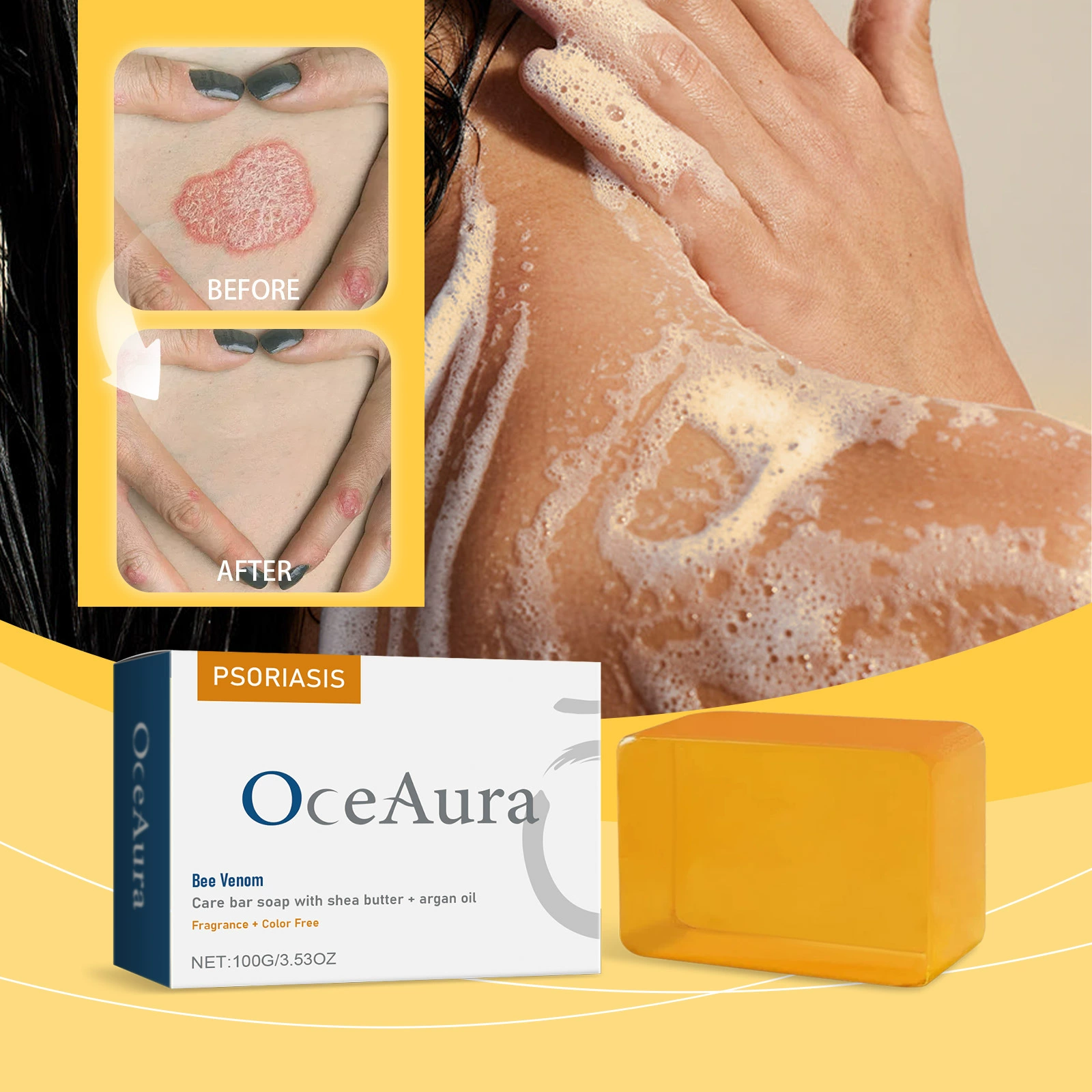 OceAura пчелиный яд мыло для ухода за псорным мхом увлажняет и восстанавливает тело