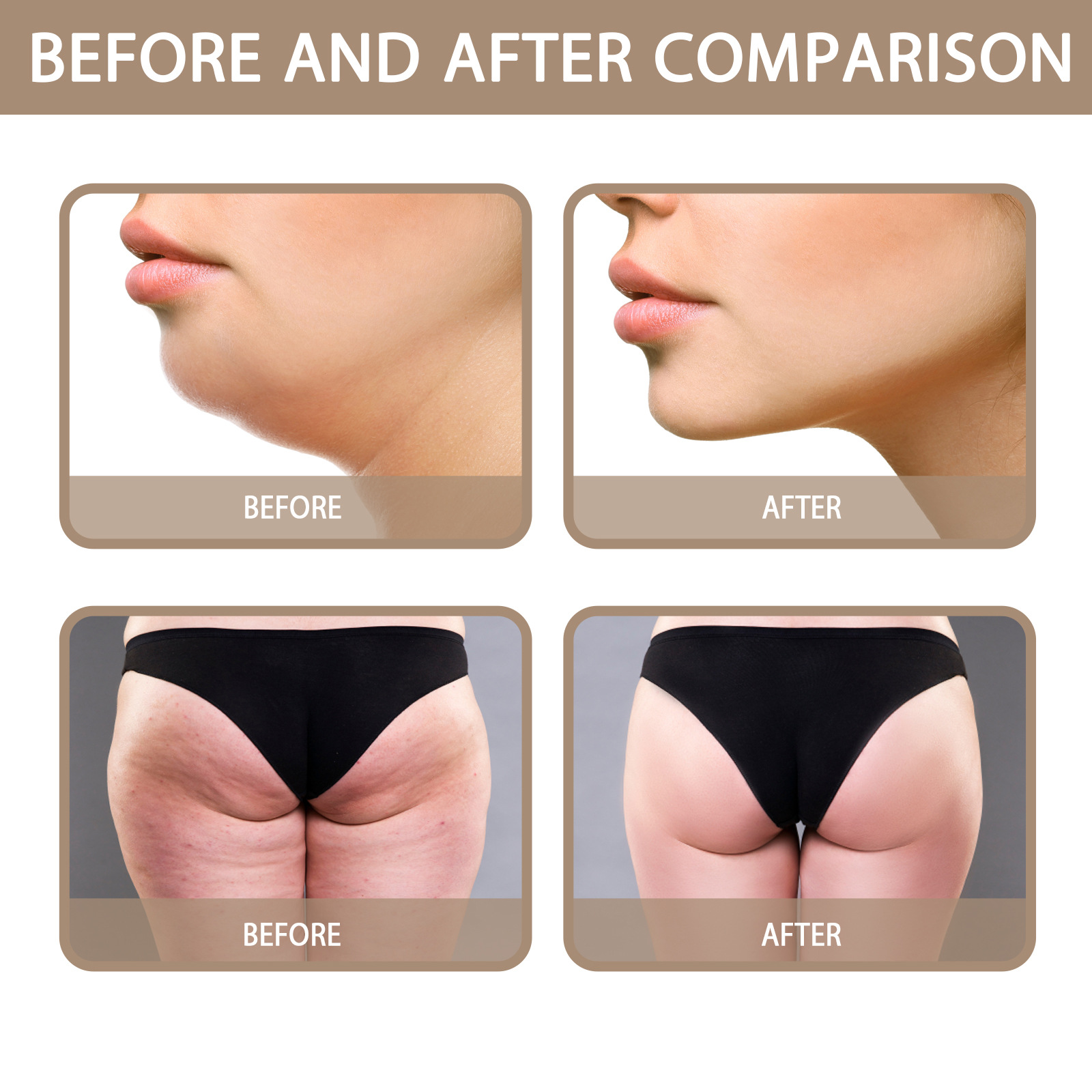 South Moon B Ginger Therapy Fever Mask Pulls Tightens Abdominal Tightness, Double Chins, Big Belly, and_voghion.com