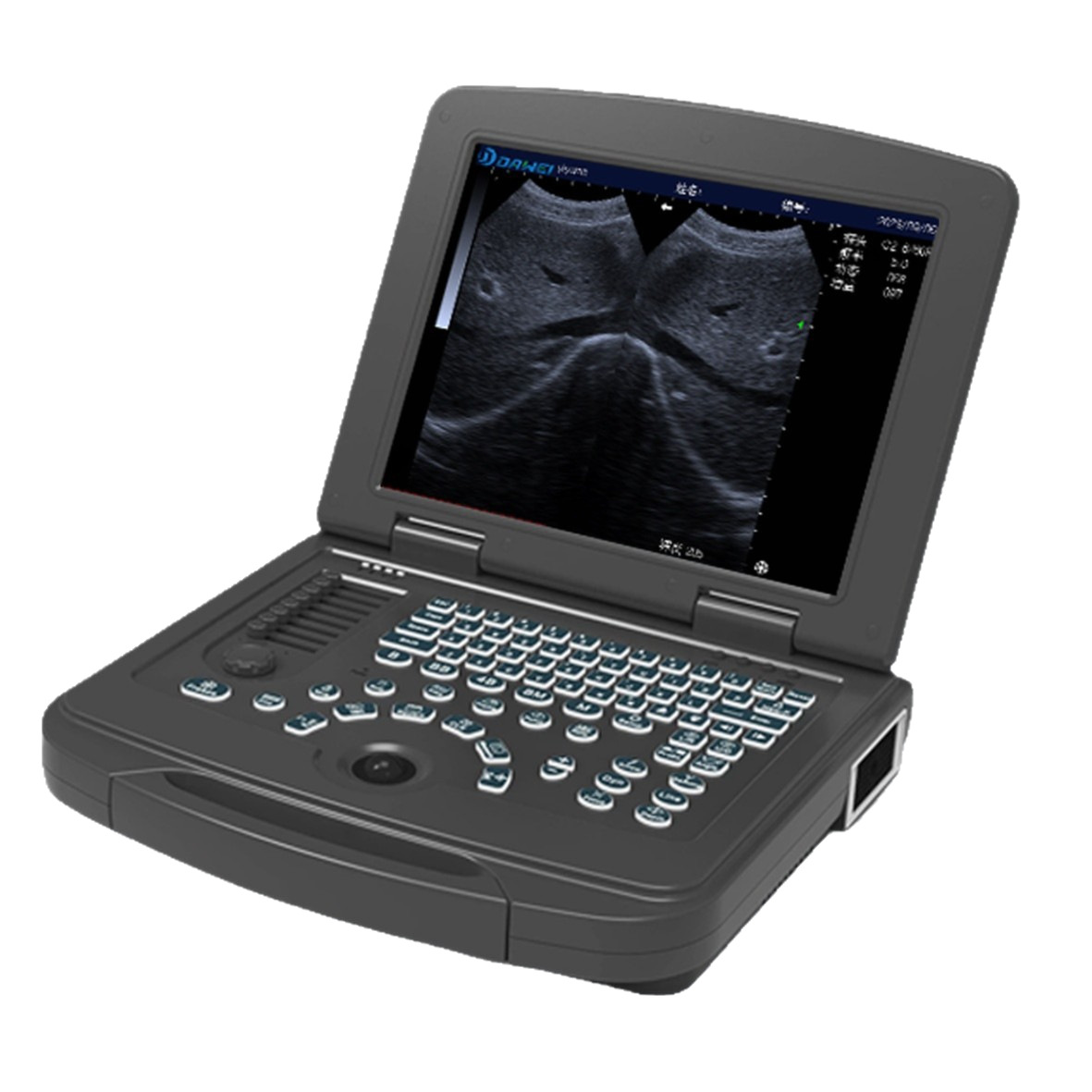 Ultrasonido portátil en blanco y negro Ultrasonido B portátil Ultrasonido B clínica de base Ultrasonido médico en blanco y negro