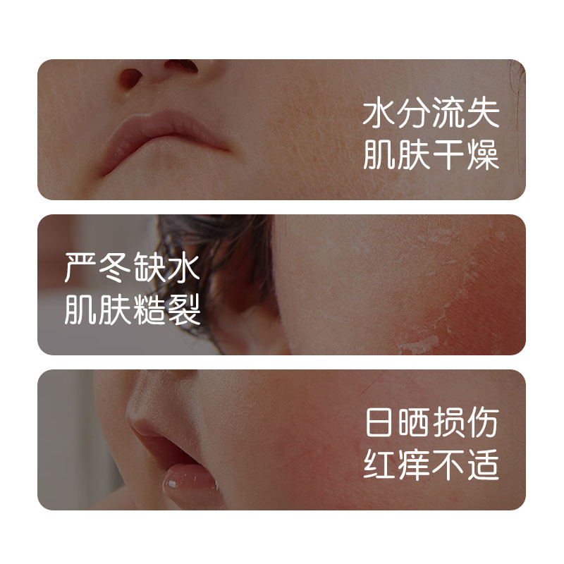 Aoduo 子供用スキンケア製品シリーズは、子供、赤ちゃん、ティーンエイジャー向けの保湿、保湿、肌の色を明るくするスキンケア製品を発送します。|undefined