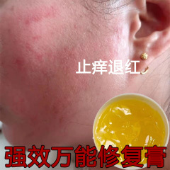 万能修復クリームは紅血糸ホルモンの顔に行って敏感肌を修復します。