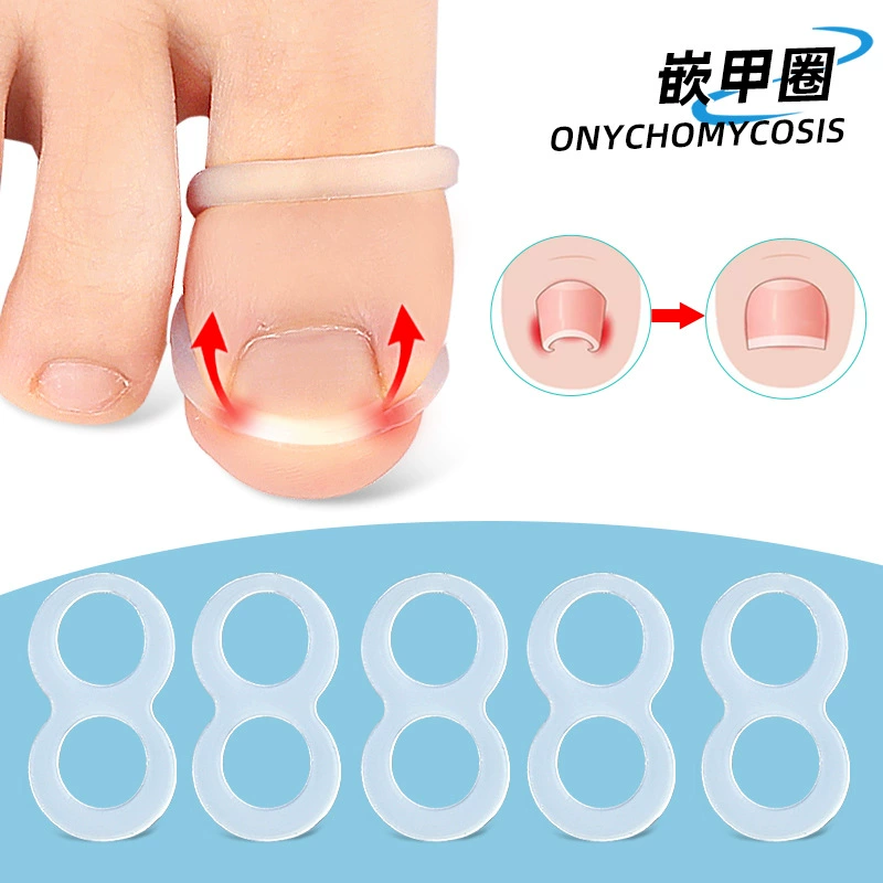 Новый мыс инкрустация Кольцо стрейч отскок ногтей паз рулон ногтей физические стрейч ходьба моющиеся повторное использование