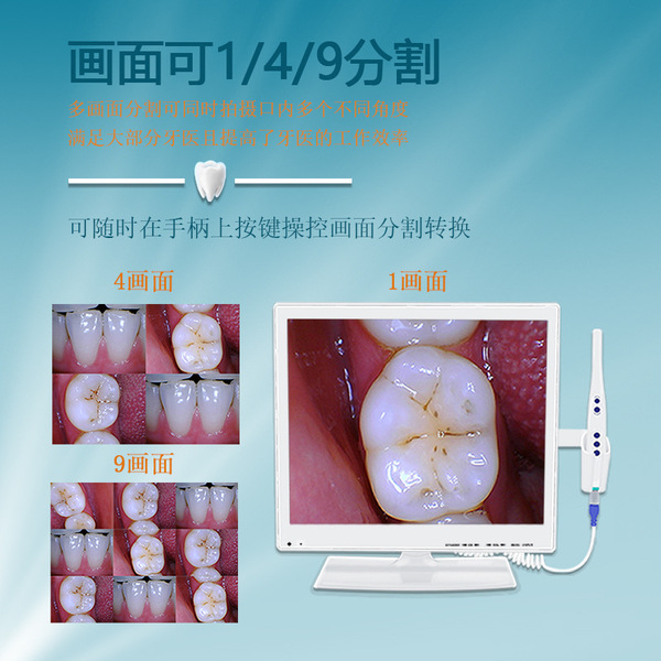 Oral endoscopy dental machine with WIFI camera to check to dental…