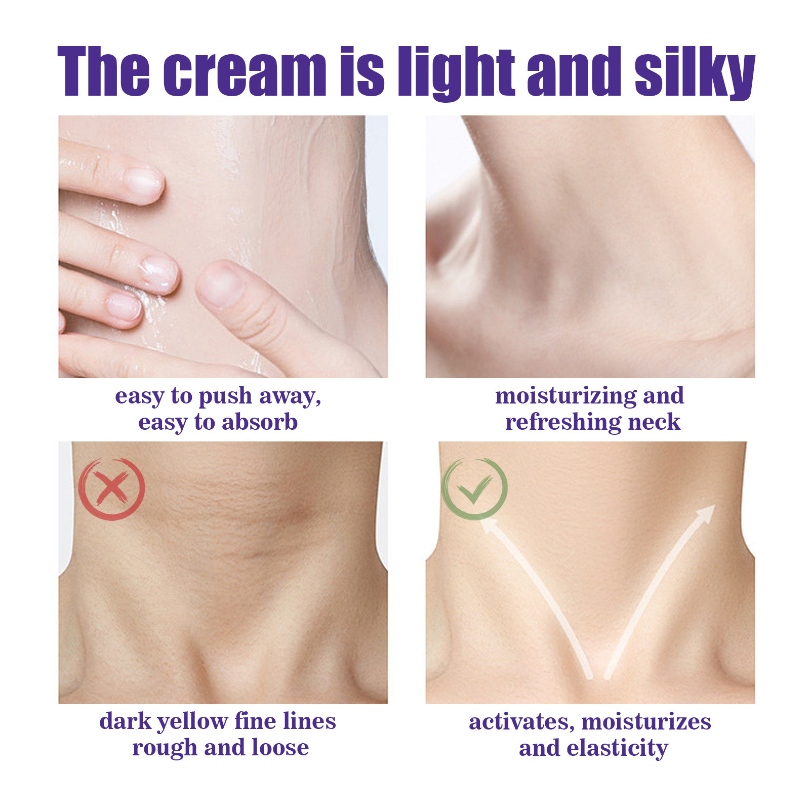 Hoygi Enhancing Firming Hidratante Pescoço, Hidratante, Branqueador, Desbotador, Suavizante e Embelezador do Pescoço Creme_voghion.com