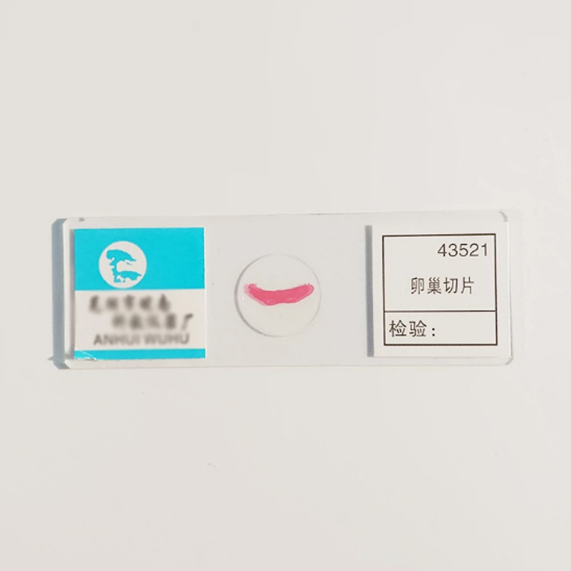 Viên nén buồng trứng
