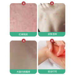 Fubishu Skin Antifungal Ointment for Anal Itching, Pruritus, Male Genitalia, External Genitalia, Buttock Skin Itching and Antifungal