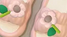 핑크 장미