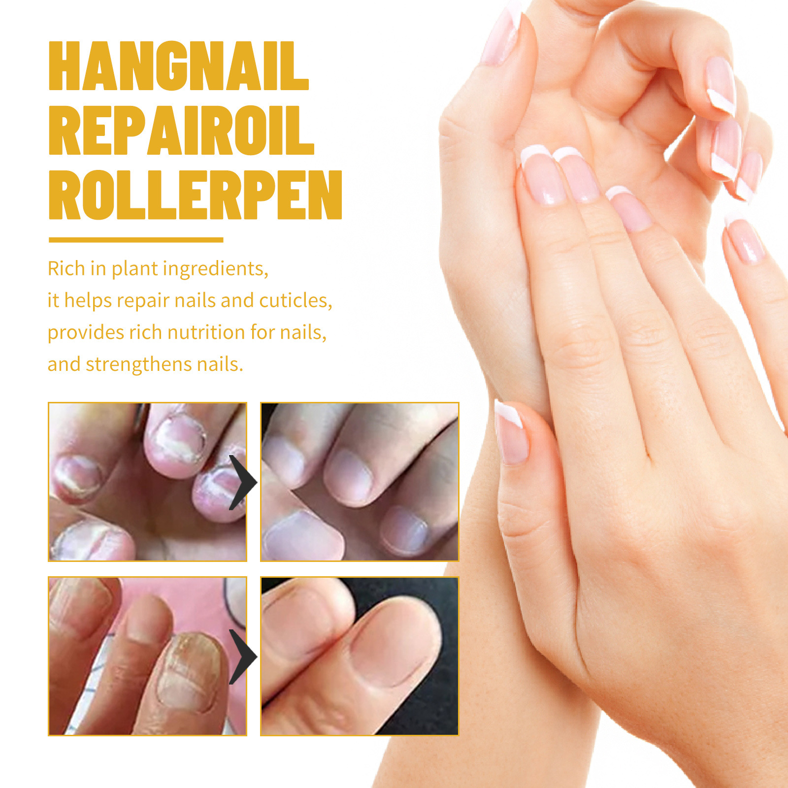 Nagel South Moon Reparatur Fingerspitze Anti-Verleumdung glänzendes Öl, Reparatur von Keratin, graue Nägel, und Glättung ing s,_voghion.com