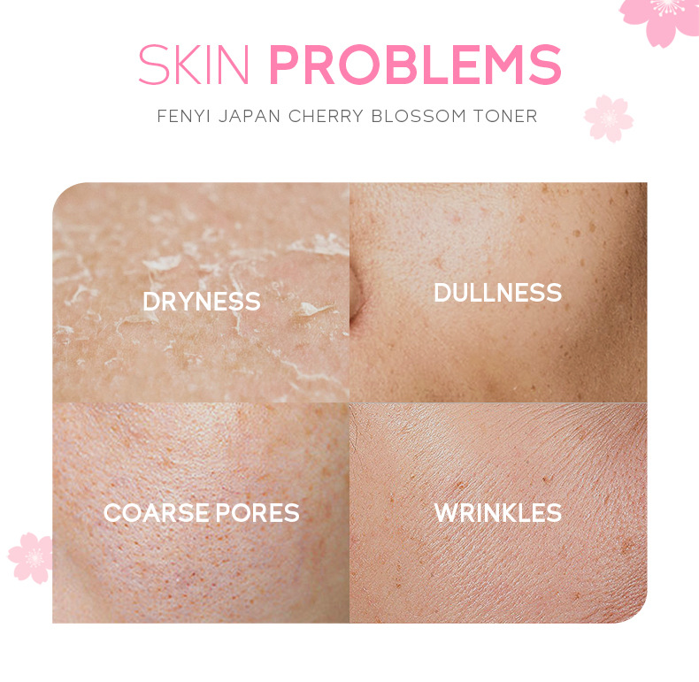 Cross-border fenyi Japanese Cherry Blossom Water 100ml Hydrating and Moisturizing Toner Skin care products Cross-border supply undefined
