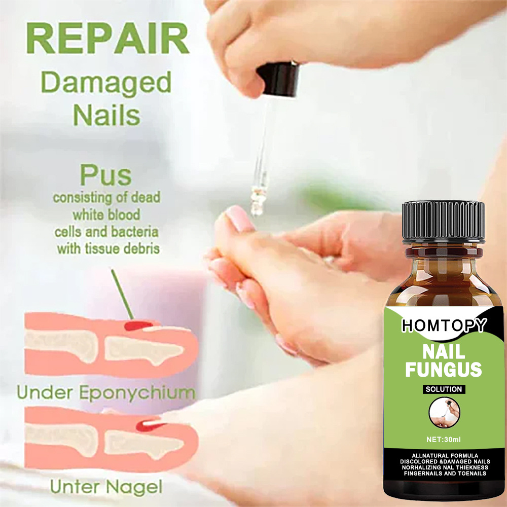 Cross-border new nail essence, gray nail repair antibacterial, gray nail liquid repair nourishing liquid, shiny nail essence liquid