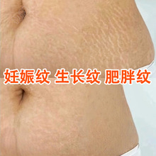 �������޸�˪Р��������Ԥ�������������ƽ����ո��������޻�˪