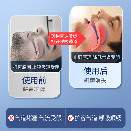 SnoreStop 30ml Liquid Snore Stop Gel for Men Snoring Prevention Spray Nasal Spray